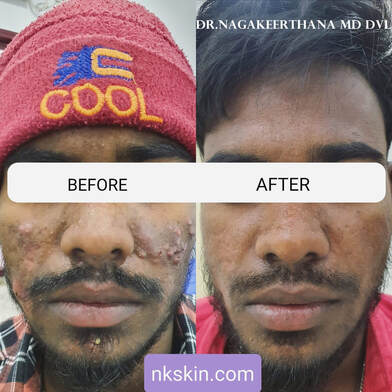 Dr. Nagakeerthana M.D NK Skin, Hair and Laser Centre Doctor Clinic  Kumbakonam