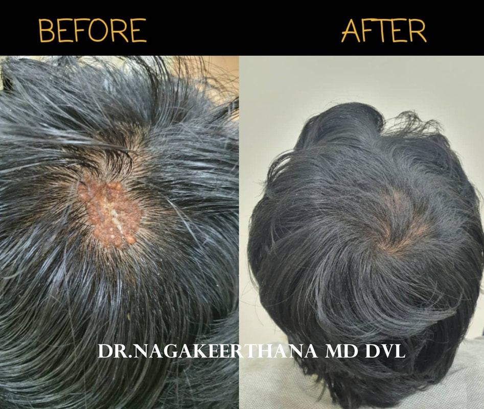 Skin and Hair Laser Centre Doctor in Thanjavur  DrNagakeerthana MD  NK  Skin Hair and Laser centre Doctor Clinic Kumbakonam